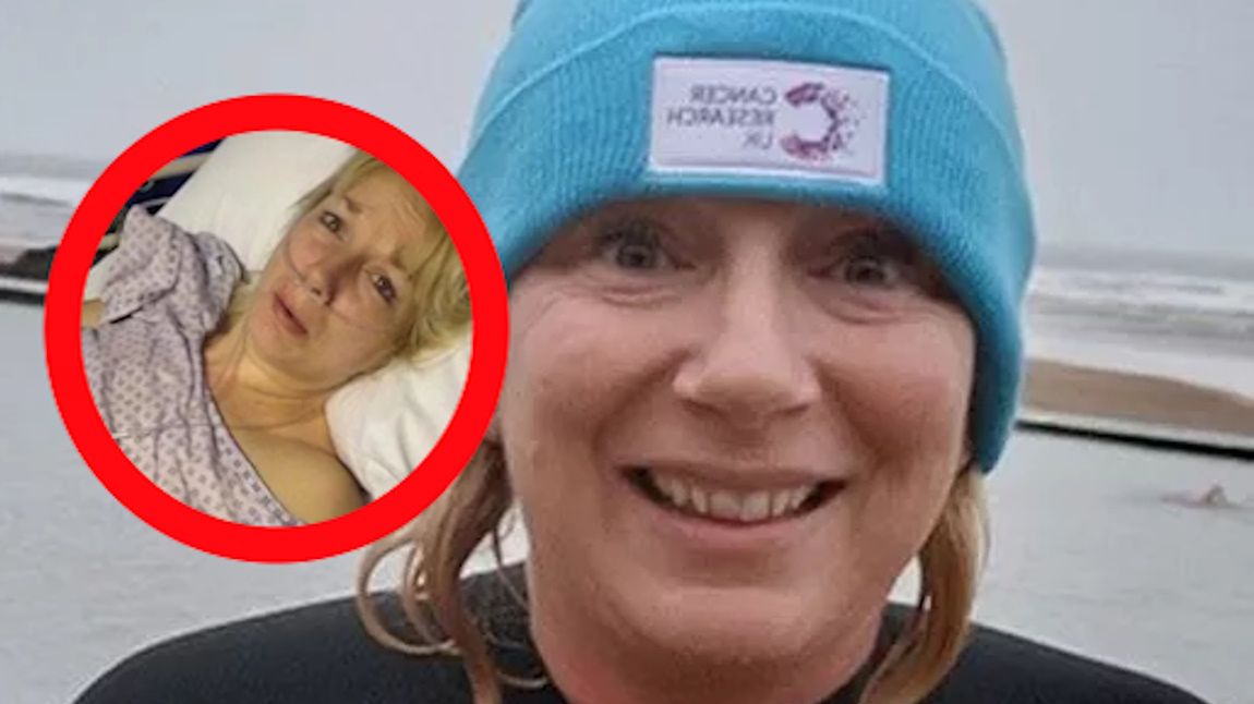 Odczuwała niewyobrażalny ból. ból. Usunięto jej połowę jelita grubego