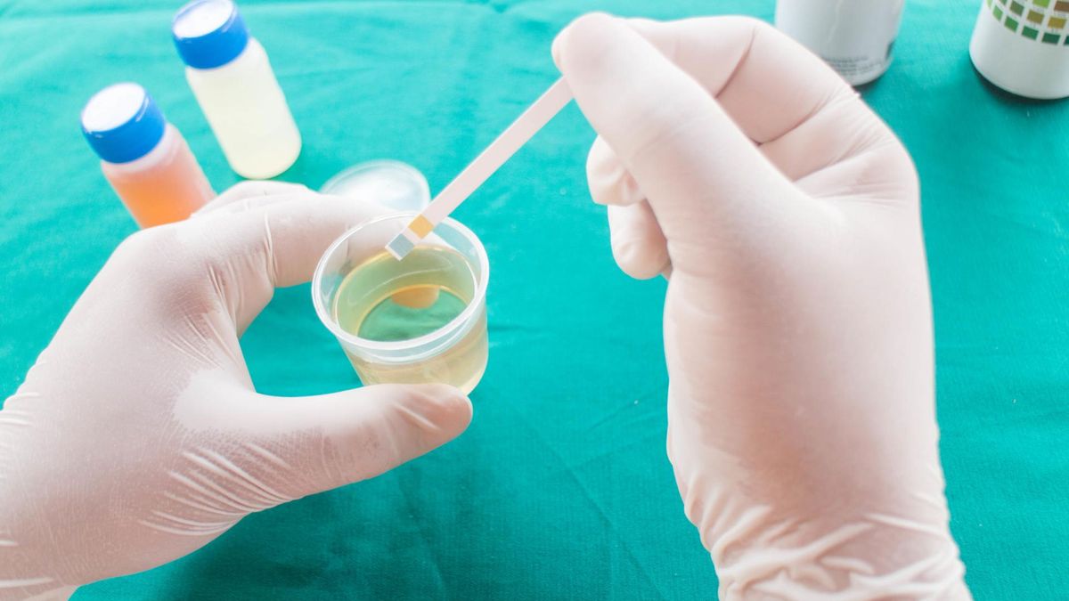 Glukoza w moczu w ciąży