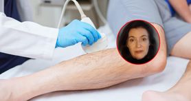 Miesiącami błąkają się od lekarza do lekarza. "Niemal połowa ma przerzuty w momencie diagnozy"