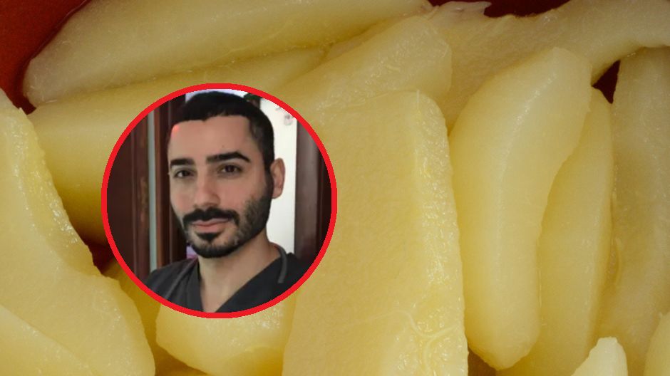 Jelita je pokochają. Lekarz mówi, które owoce je trawienie