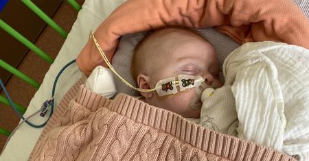 Niemowlę zaczęło źle oddychać. Okazało się, że ma "truskawkowe znamię"