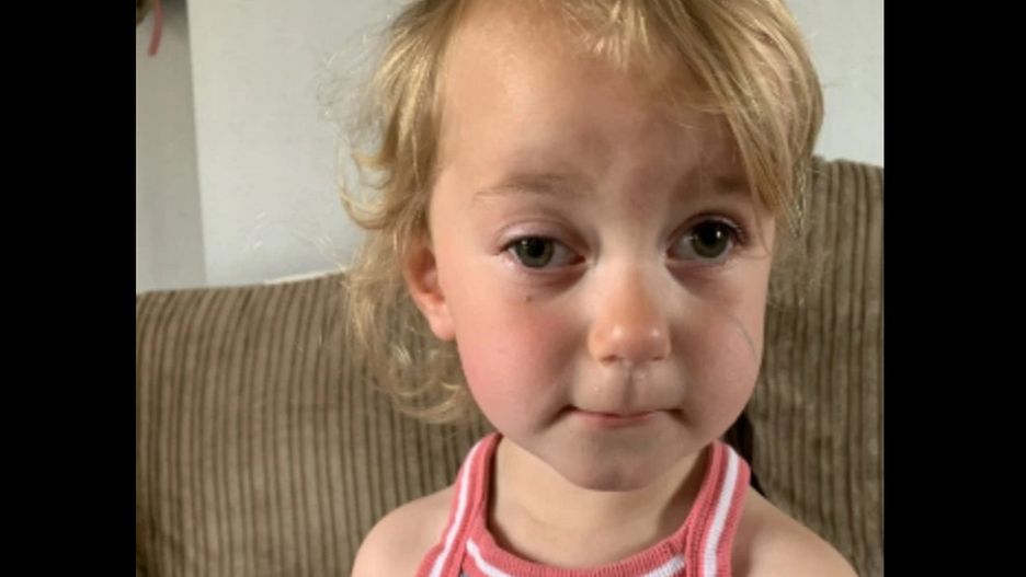 "Leniwe oko" okazało się zwiastunem ciężkiej choroby. Mama ostrzega innych rodziców