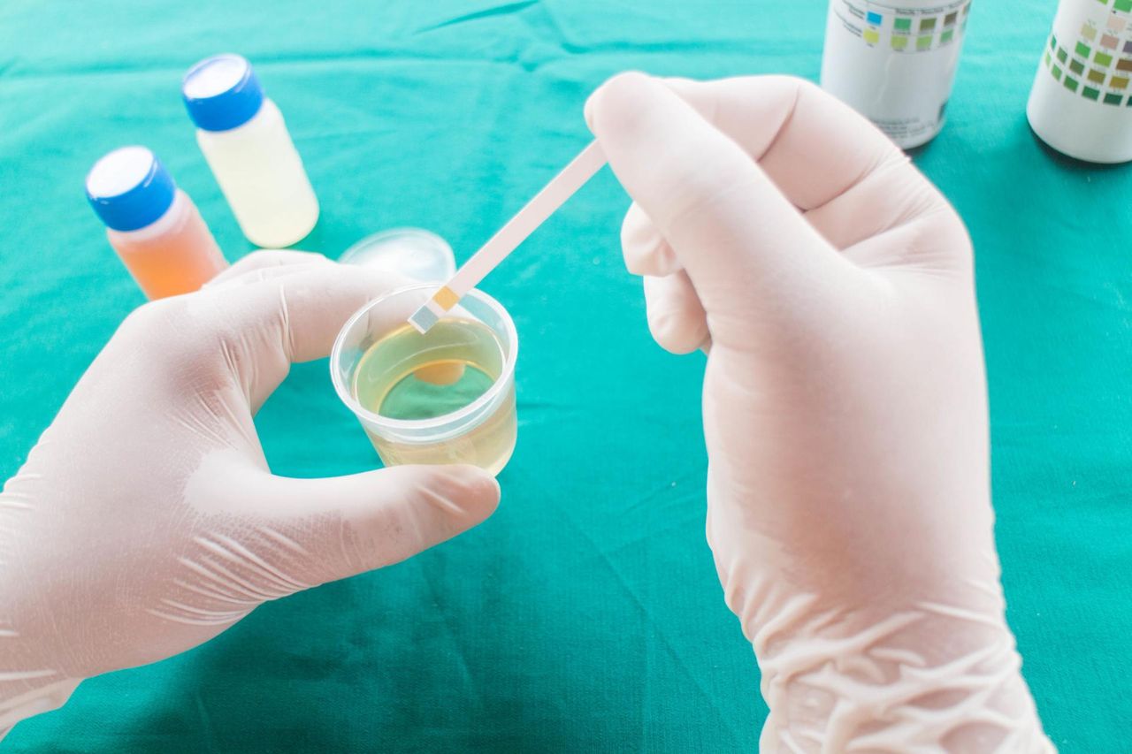 Bakterie w moczu u dzieci – przyczyny, objawy, diagnostyka i leczenie