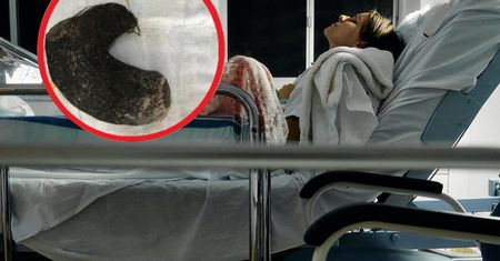 Myśleli, że to guz. Byli w szoku, gdy zbadali żołądek nastolatki