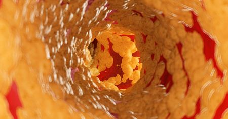 Obniż poziom cholesterolu w zaledwie miesiąc. Wystarczą cztery kroki