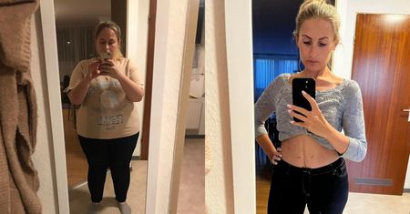 Agnieszka, Iwona i Monika przeszły operacje bariatryczne. Żałują jednego