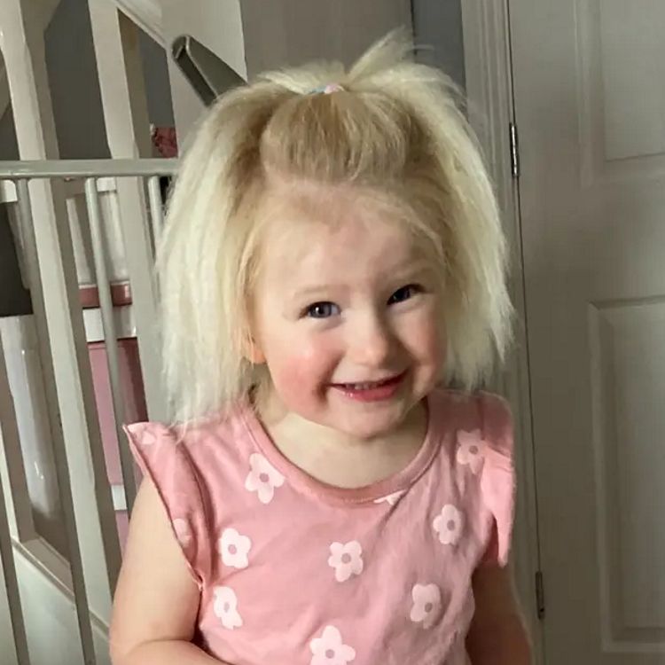 Choroba często ustępuje, gdy dziecko wchodzi w wiek dojrzewania