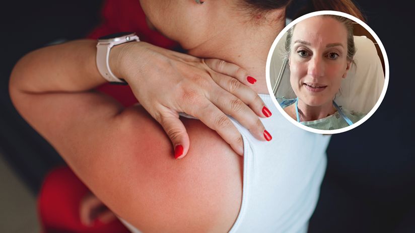 Zaczęło się od promieniującego bólu ramienia. W szpitalu dowiedziała się, że to zawał serca