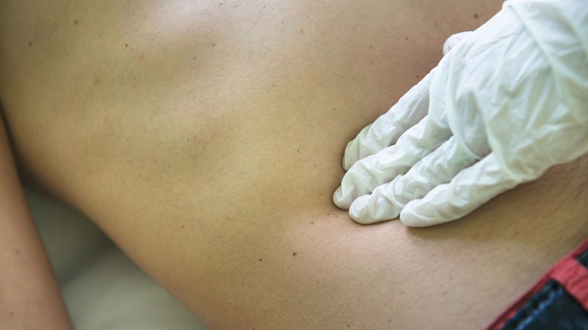 Nowa przyczyna raka jelita grubego u młodych. Winna konkretna dieta