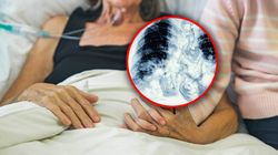 Rak, którego fundujemy sobie sami. Będzie nas zaraz kosztować 20 mld rocznie