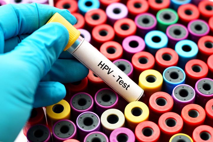 Brakuje szczepionek na HPV