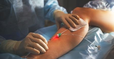 Żylaki szpecą nogi? Nie czekaj, aż rozwinie się zakrzepica