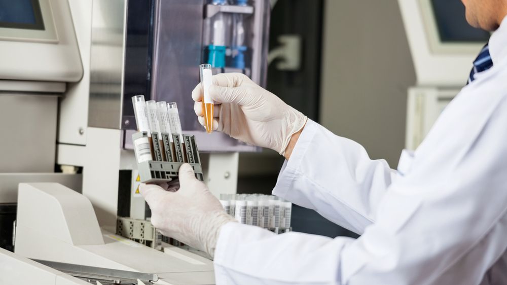 Krwiomocz wymaga przeprowadzenia badań laboratoryjnych celem zbadania przyczyny jego wystąpienia.