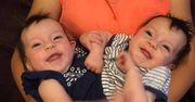 Urodziły się zrośnięte. Matka pokazała, jak wyglądają po 6 latach