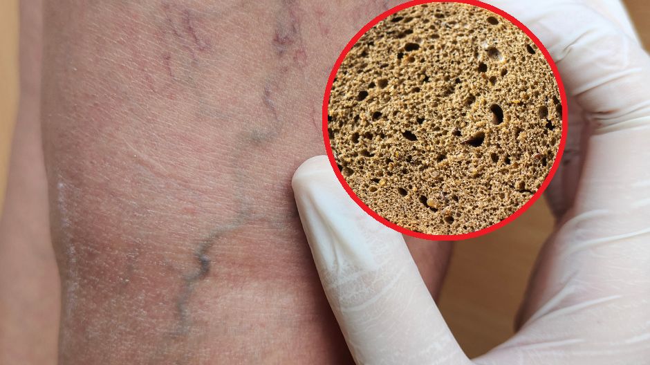 Warto włączyć do diety błonnik