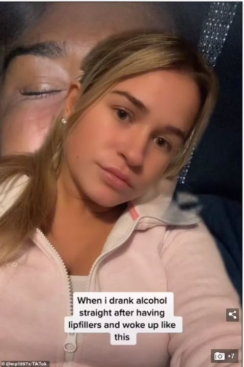 Morgan Proudlock chciała powiększyć usta, wstrzykując kwas hialuronowy