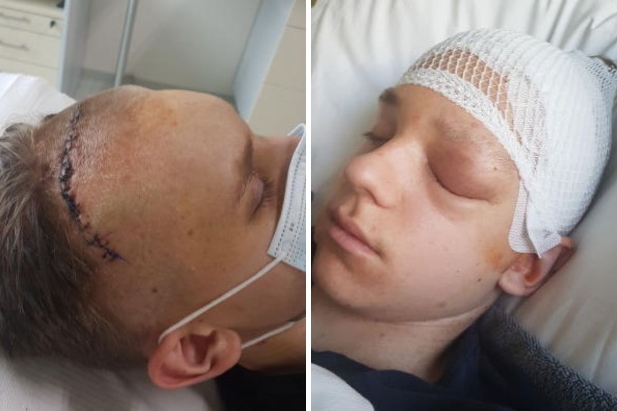 Michał ma guzy na twarzy, w okolicach czaszki, kręgosłupa i innych miejscach