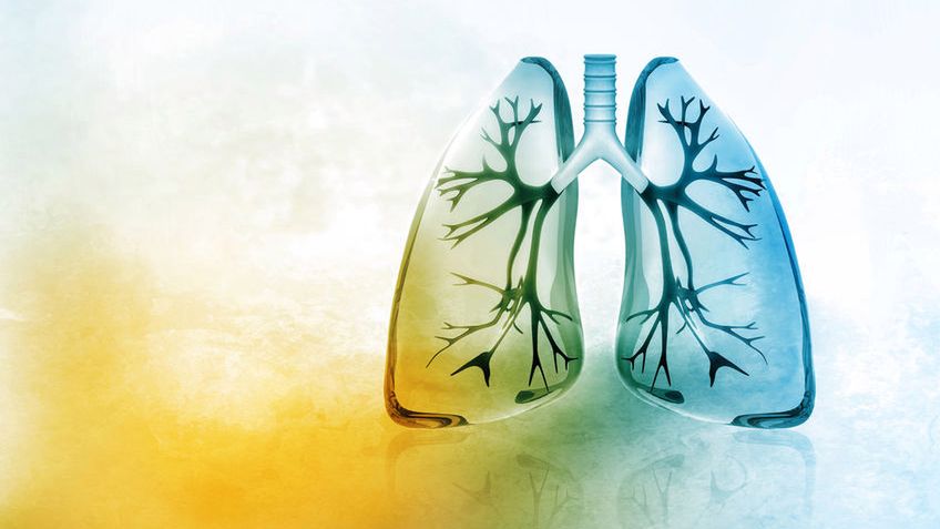 Zwapnienie płuc to częsty objaw rozpoznawany podczas prześwietlenia klatki piersiowej