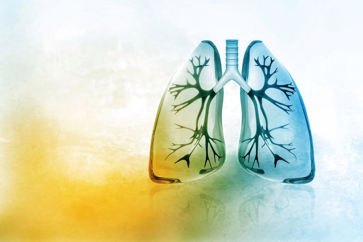 Zwapnienie płuc to częsty objaw rozpoznawany podczas prześwietlenia klatki piersiowej