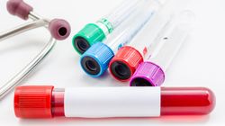 Grupa krwi 0 - skąd się wzięła i czym się wyróżnia. Dieta dla posiadaczy takiej krwi