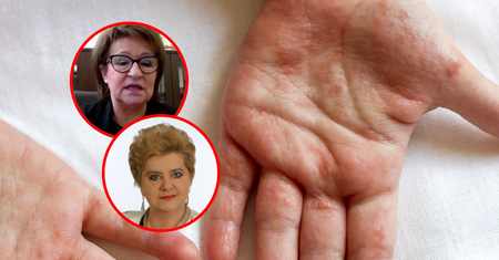 Polacy walczą z superbakteriami. "Mamy wysyp dwóch chorób"
