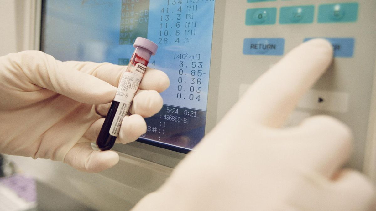 Najrzadszą znaną grupą krwi jest AB Rh-