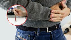 Bardzo wczesny objaw raka jelit. Coraz częściej atakuje młodych