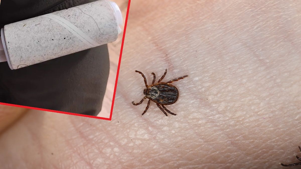 Tani i prosty sposób na pozbycie się kleszczy z ubrań