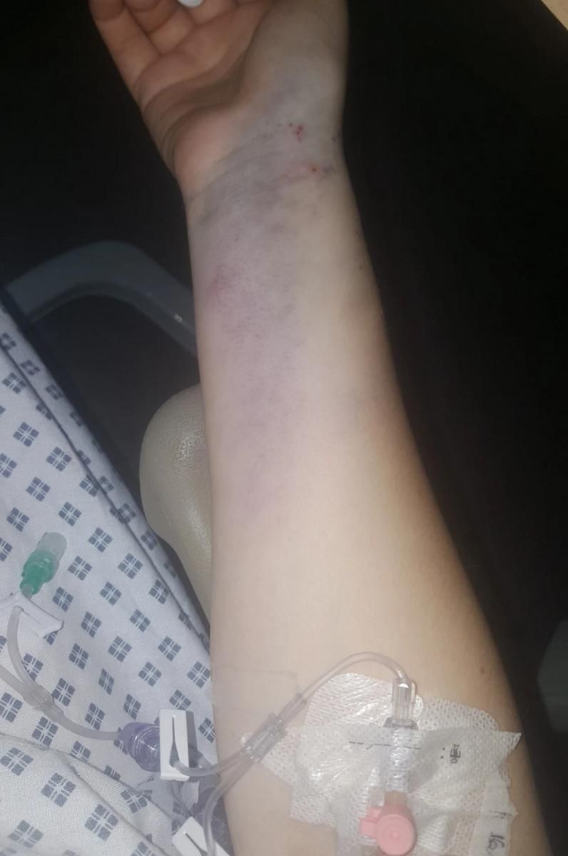 &quot;Wszystko mnie bolało, na moich rękach pojawiły się niebieskie plamy&quot;