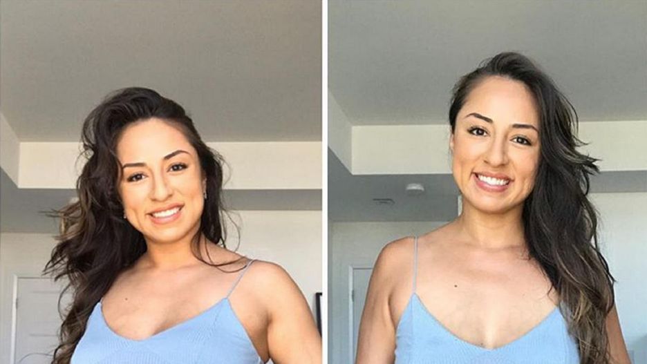 Brzuch po bliźniaczej ciąży