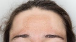 Plamy na ciele - brązowe przebarwienia, czerwone guzy, rumień