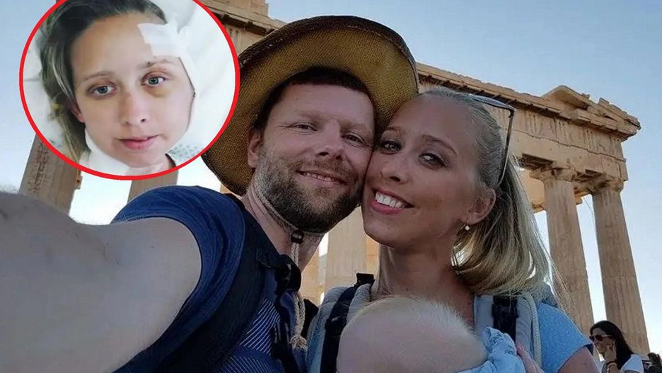 U mamy dwójki dzieci zdiagnozowano rzadki nowotwór skóry