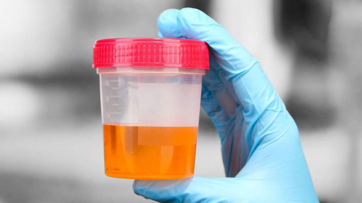 Badanie moczu u niemowląt