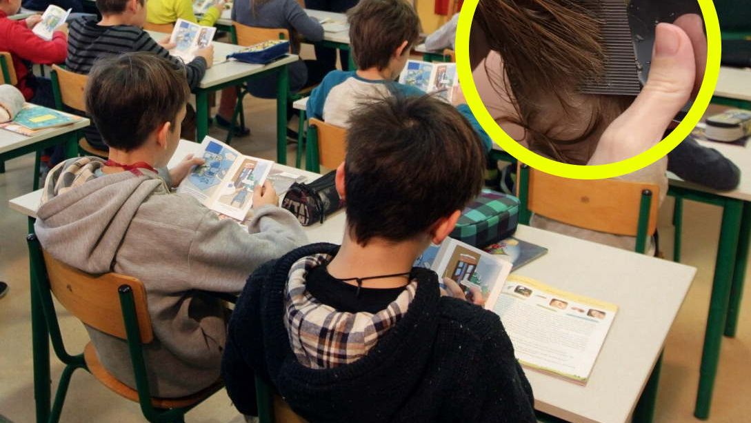 Czeka nas wysyp problemów z wszami? Pozbędziesz się ich tą metodą