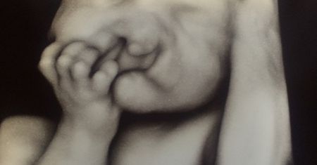 Odmówili aborcji synka z powodu deformacji. Tak chłopiec wygląda dzisiaj