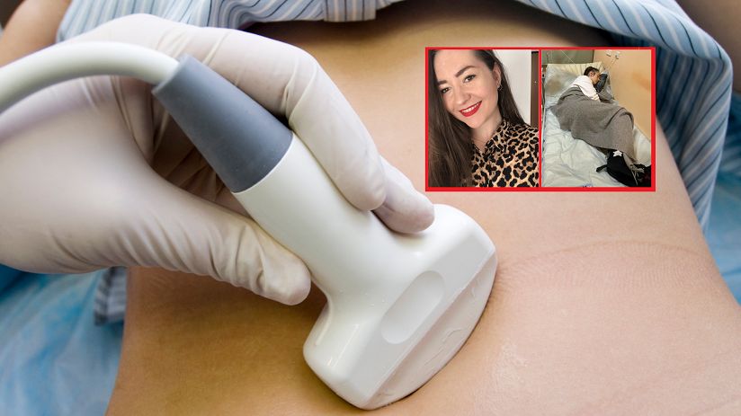 Leczyli ją na kręgosłup, a nowotwór rozwijał się błyskawicznie