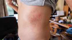 50 tys. przypadków rocznie. Połowa chorych Polaków umiera