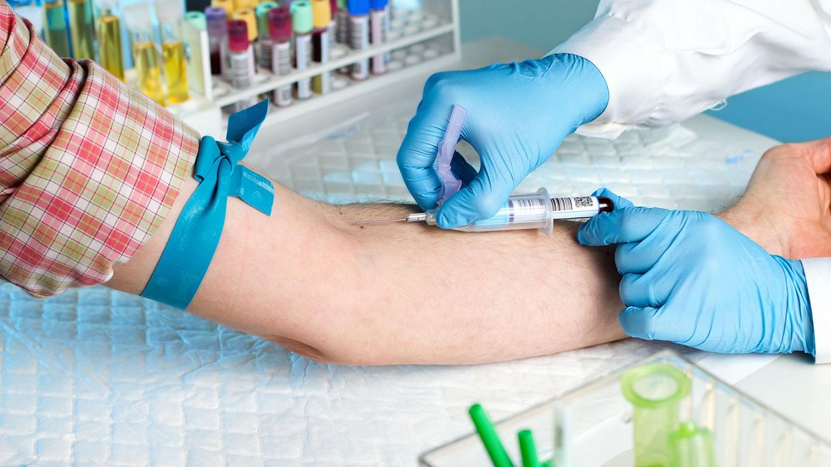 Badanie poziomu hormonów