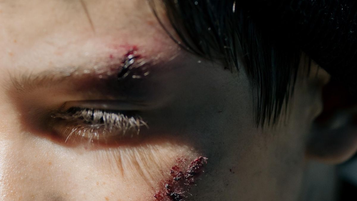 Cepan to krem leczniczy, który stosuje się w leczeniu blizn oraz bliznowców po oparzeniach, zabiegach chirurgicznych, czyrakach, owrzodzeniach i trądziku.