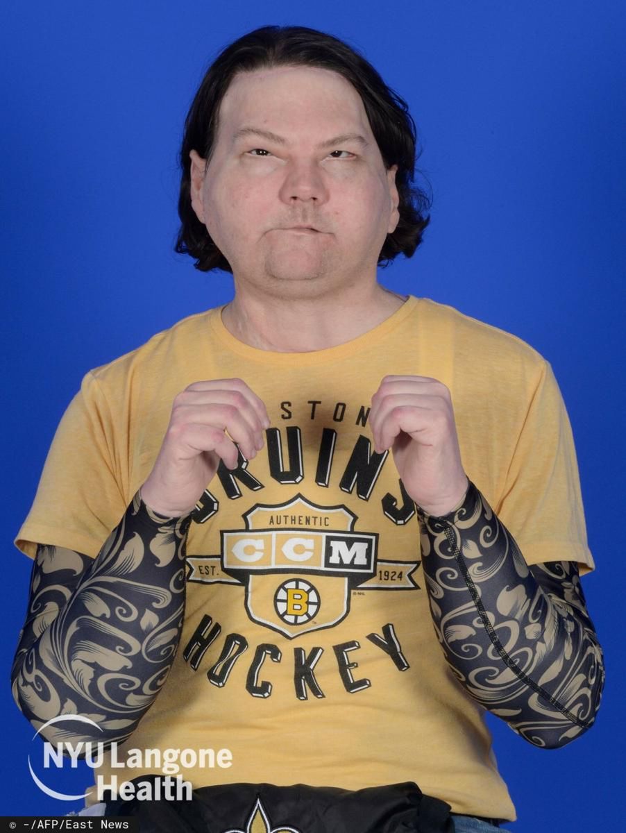 Joe DiMeo po operacji