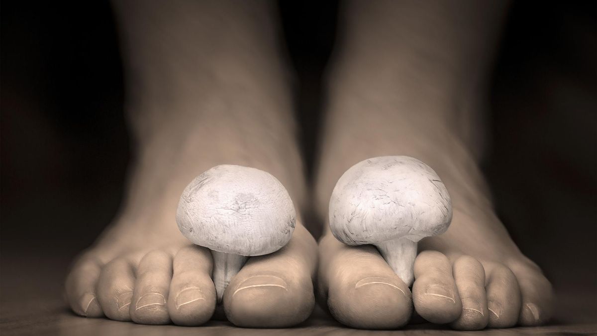 Grzybica stóp to jedna z częściej występujących odmian tej choroby