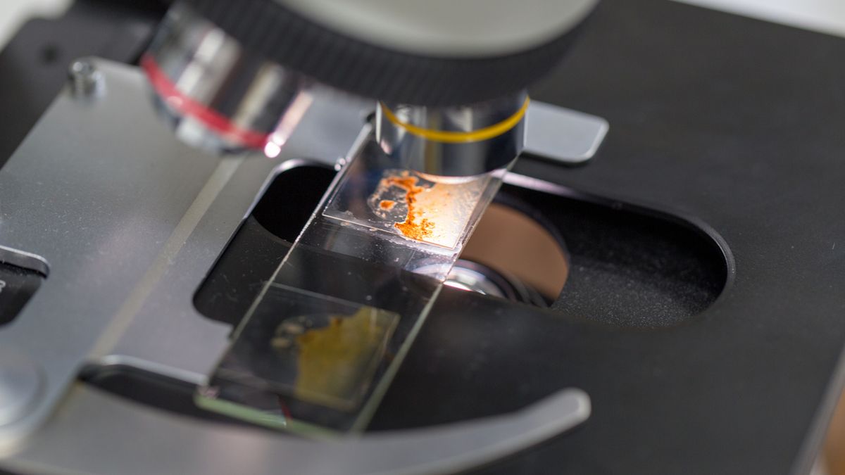 Pierwotniaki jelitowe mogą wywoływać między innymi problemy z układem pokarmowym i skórą.