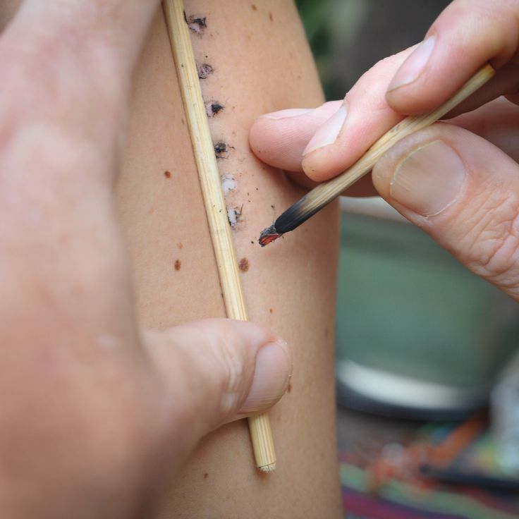 Ceremonia Kambo / pinterest