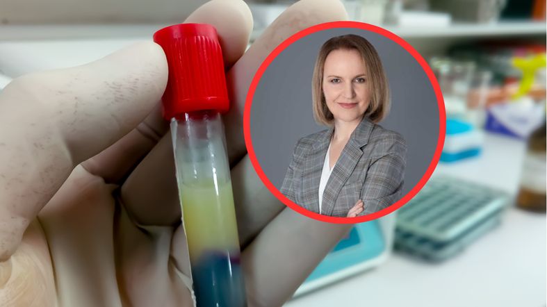 Kardiolog mówi, jakie objawy daje wysoki cholesterol i jak go zbić