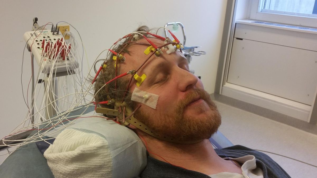 Nawet 40 proc. chorych może zmagać się z padaczką lekooporną