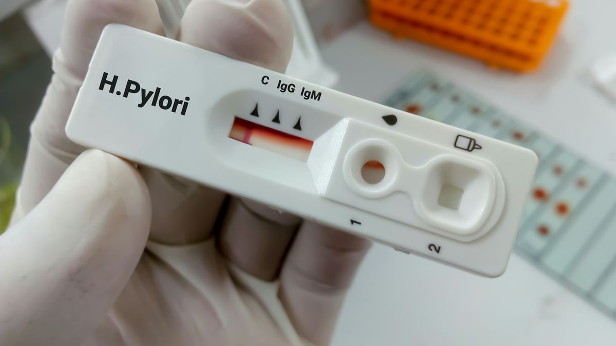 Helicobacter pylori to Gram-ujemna bakteria, która zasiedla błonę śluzową żołądka.