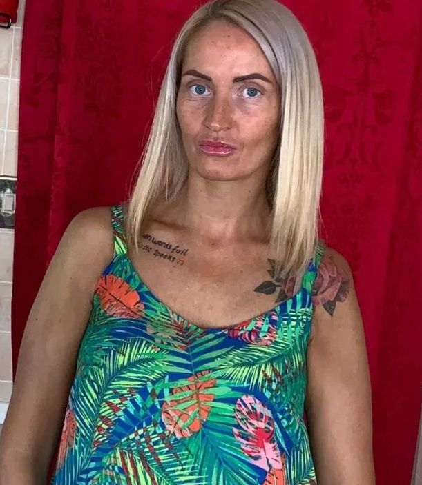 35-latka pozbyła się samoopalacza