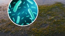 Czyhają w wodzie. Zanim wyjedziesz, sprawdź, gdzie jest bezpiecznie