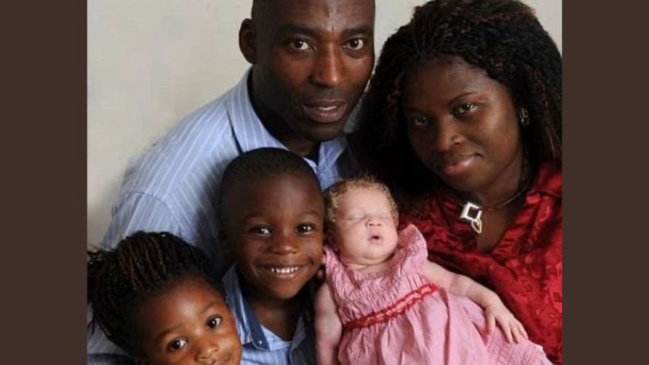Nigeryjskiej parze urodziło się białe dziecko