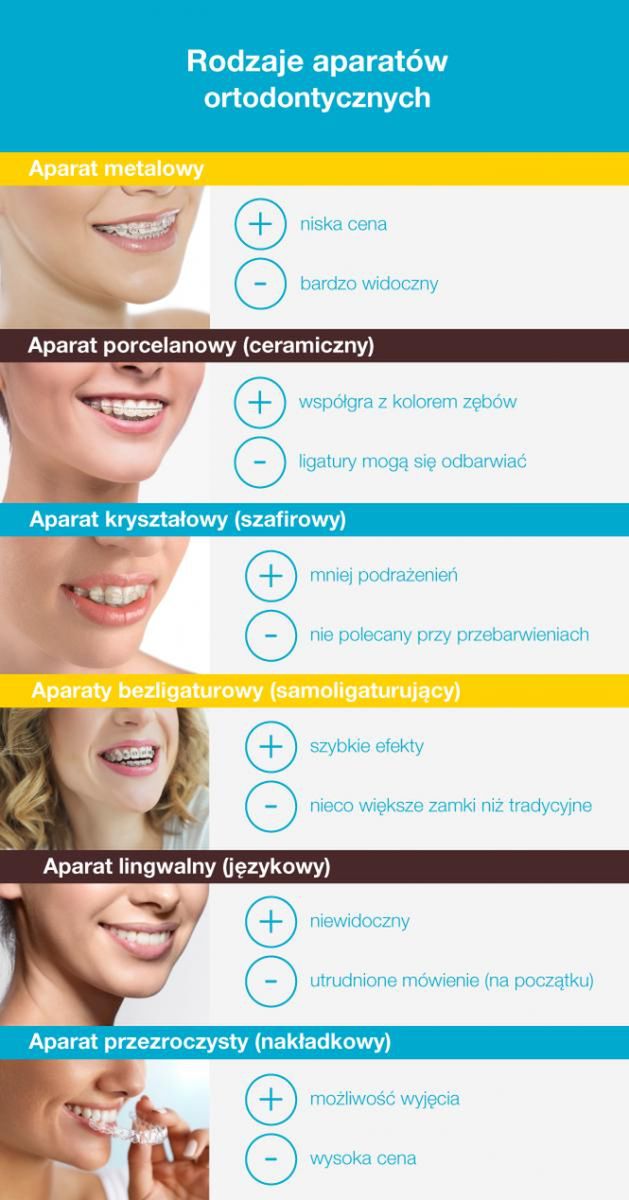 Istnieje wiele rodzajów aparatów ortodontycznych